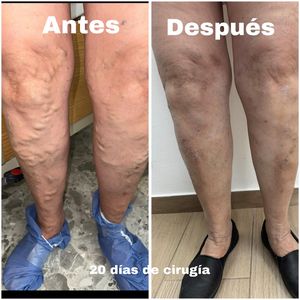 Image post by @dr.vicentevascular on Instagram