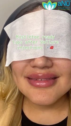 Video post by @anuaestheticsandwellness on Instagram