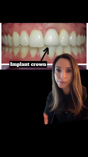 Video post by @weisstorortho on TikTok