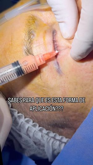 Video post by @dr.josevalencia on Instagram