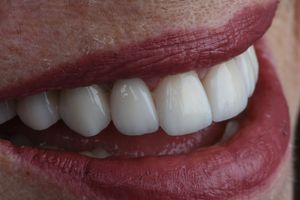 Image post by @sharpdentistry on Instagram