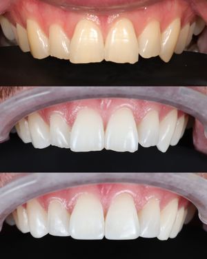Image post by @fahaddentist on Instagram
