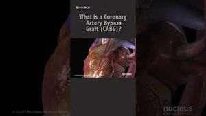Video post by @nucleusmedicalmedia on YouTube