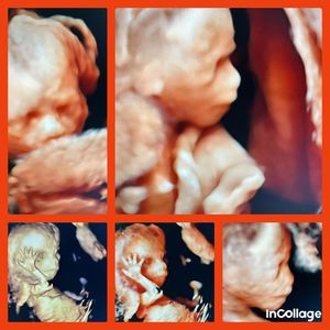 Image post by @dr.aliriogrisanti on Instagram