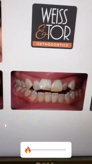 Video post by @weisstorortho on TikTok
