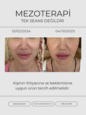 Image post by @drozlemteberik on Instagram