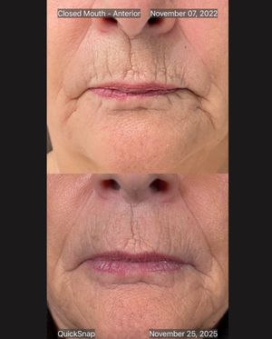 Image post by @therealplasticsurgeon on Instagram