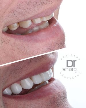 Image post by @sharpdentistry on Instagram