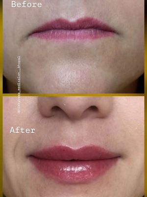 Image post by @nikkybawamedisalonbhopal on Instagram