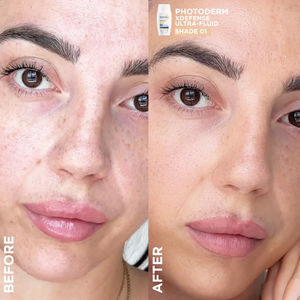 Image post by @biodermame on Instagram
