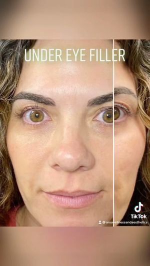 Video post by @anuaestheticsandwellness on Instagram