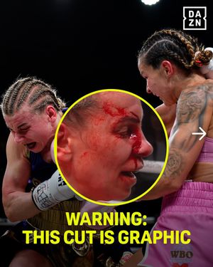 Image post by @daznboxing on Instagram