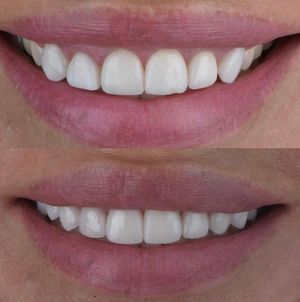 Image post by @sharpdentistry on Instagram