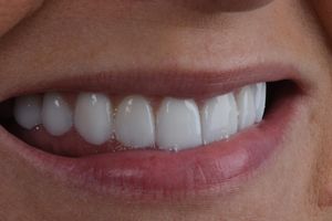 Image post by @sharpdentistry on Instagram