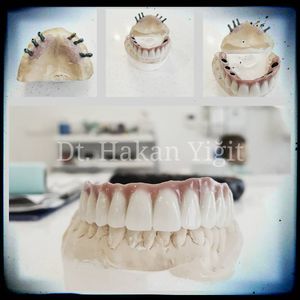 Image post by @dentamerzifon on Instagram