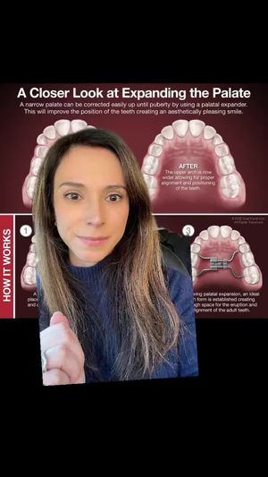 Video post by @weisstorortho on TikTok