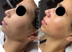 Image post by @nicolecarolineskin on Instagram