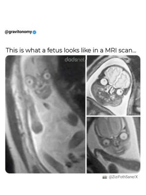 Image post by @gravitonomy on Instagram