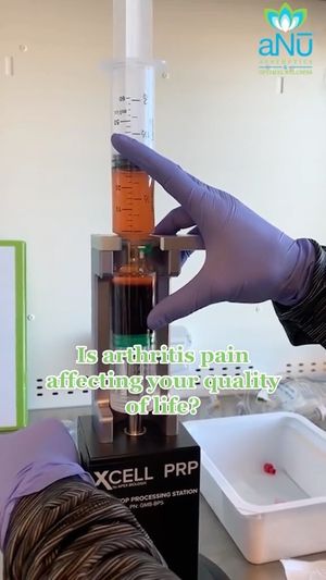 Video post by @anuaestheticsandwellness on Instagram