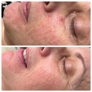 Image post by @carolinewatsonbeauty on Instagram