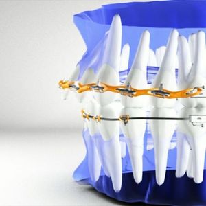 Video post by @drrezdental on Facebook