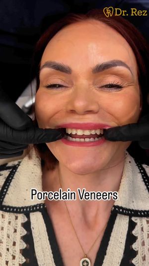 Video post by @drrezdental on Facebook