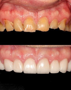 Image post by @fahaddentist on Instagram
