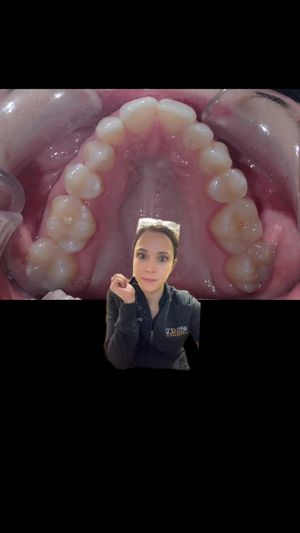 Video post by @weisstorortho on TikTok