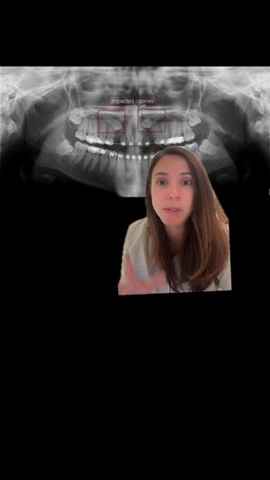 Video post by @weisstorortho on TikTok