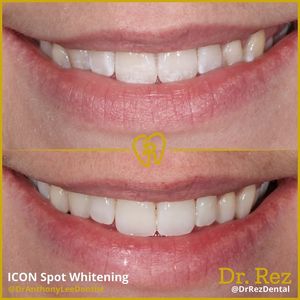Image post by @drrezdental on Facebook