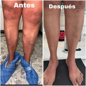 Image post by @dr.vicentevascular on Instagram
