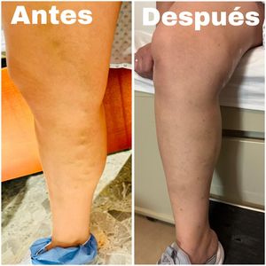 Image post by @dr.vicentevascular on Instagram