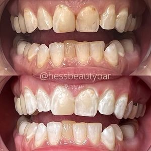 Image post by @HessBeautyBar on Facebook