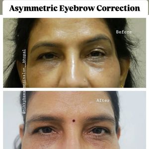 Image post by @nikkybawamedisalonbhopal on Instagram