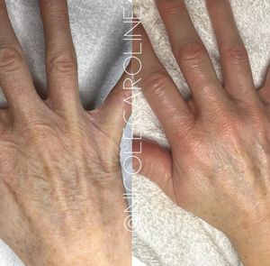 Image post by @nicolecarolineskin on Instagram