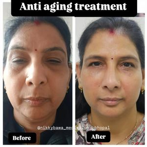 Image post by @nikkybawamedisalonbhopal on Instagram
