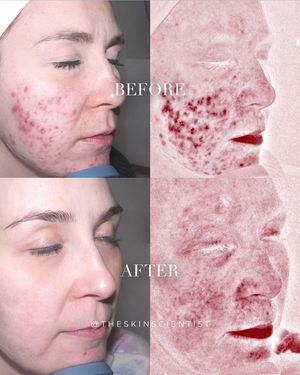 Image post by @theskinscientist on Instagram