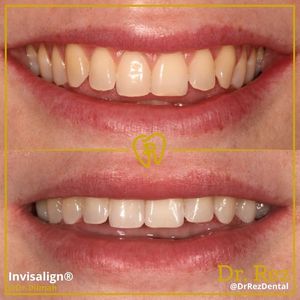 Image post by @drrezdental on Facebook