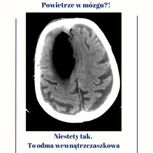 Image post by @neurochirurg_litak on Instagram