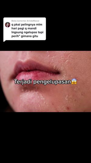 Video post by @lili.refliskin on TikTok