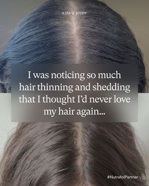 Image post by @nutrafol on Instagram