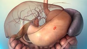 Video post by @nucleusmedicalmedia on YouTube