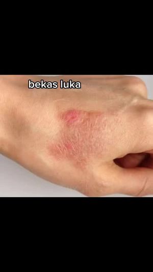 Video post by @lili.refliskin on TikTok