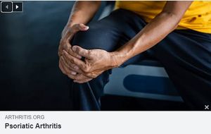 Image post by @PiedmontArthritisClinic on Facebook