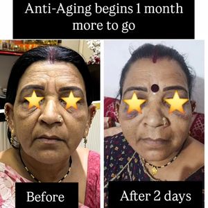 Image post by @nikkybawamedisalonbhopal on Instagram