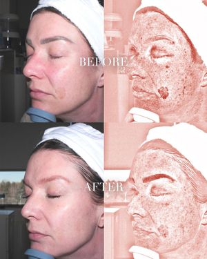 Image post by @theskinscientist on Instagram