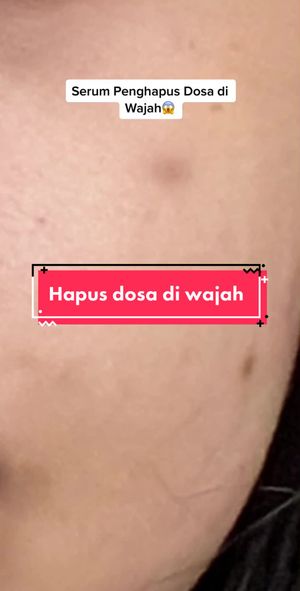 Video post by @lili.refliskin on TikTok