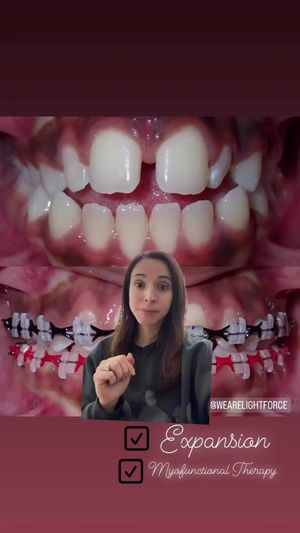 Video post by @weisstorortho on TikTok