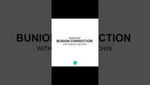 Video post by @thebunionking on YouTube