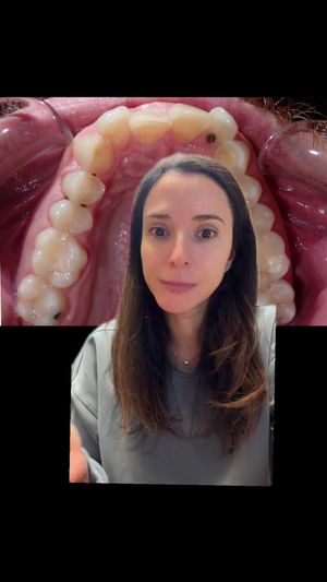 Video post by @weisstorortho on TikTok